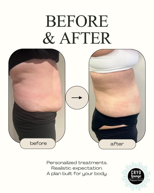 Body contouring is not one-size-fits-all.

Your starting point, goals and treatment area all help determine the right number of sessions. We begin with a consultation, create a personalized plan and track progress along the way.

Results vary. Message CONSULT to get started.

#cryolounge #cryotherapy #bodycontouring #nwa